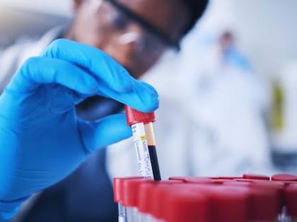Blood test